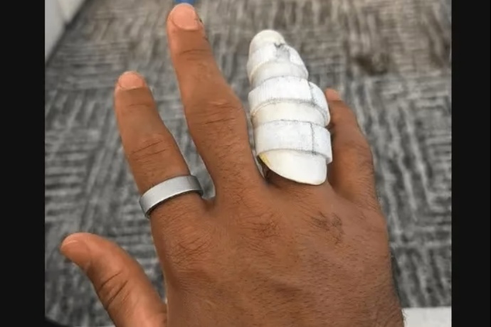 哈特曬術(shù)后無名指護(hù)具照，湖人后衛(wèi)線恢復(fù)進(jìn)程引關(guān)注